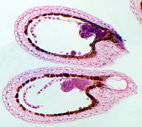Capsella mlad embryo, sec.