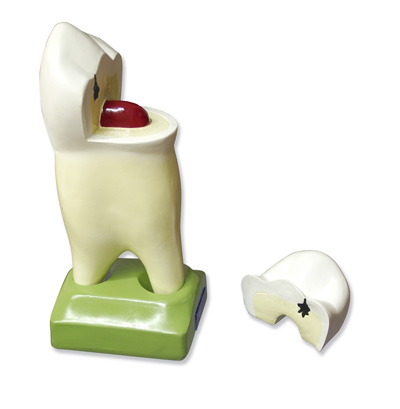 Horná premoláre, 2 korene