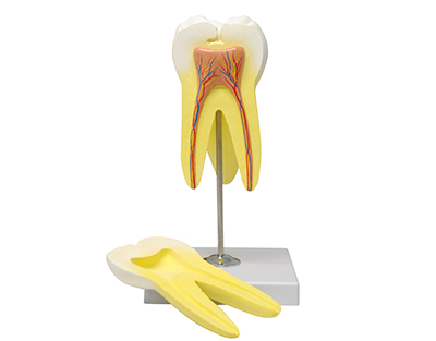 Model zubu - Horné stoličky, 3 korene