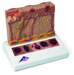 Model - Rakovina koe