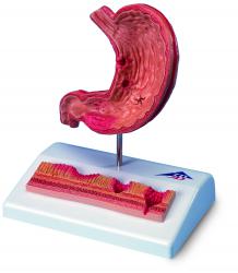 Model - aldok s vredom