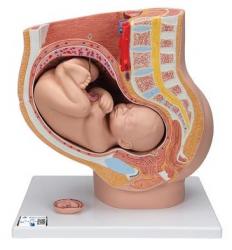 Model - Panva v tehotenstve, 3-dielna