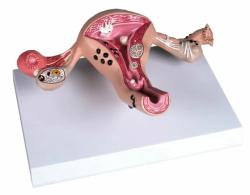 Model ochorenia enskej maternice