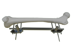 CASSOFIX model 3D long CASSOFIX model 3D long