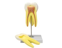 Model zubu - Horné stoličky, 3 korene Model zubu - Horné stoličky, 3 korene