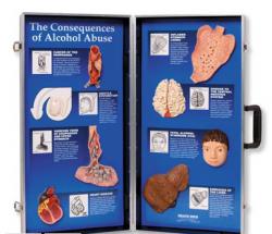 Dsledky alkoholu - 3D panel