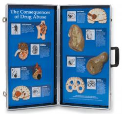 Dsledky drog - 3D panel